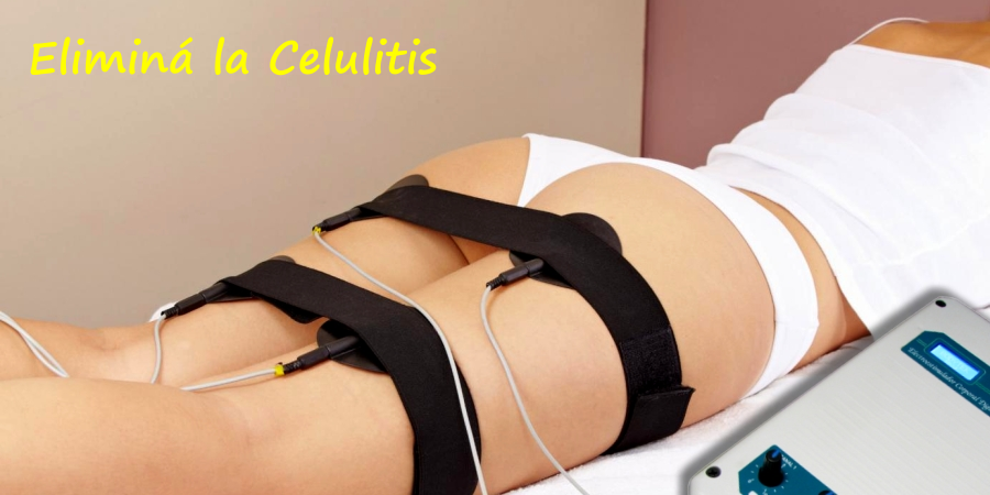 Celulitis